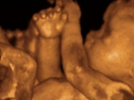 Ultrassonografia 4D e o desenvolvimento emocional do bebê